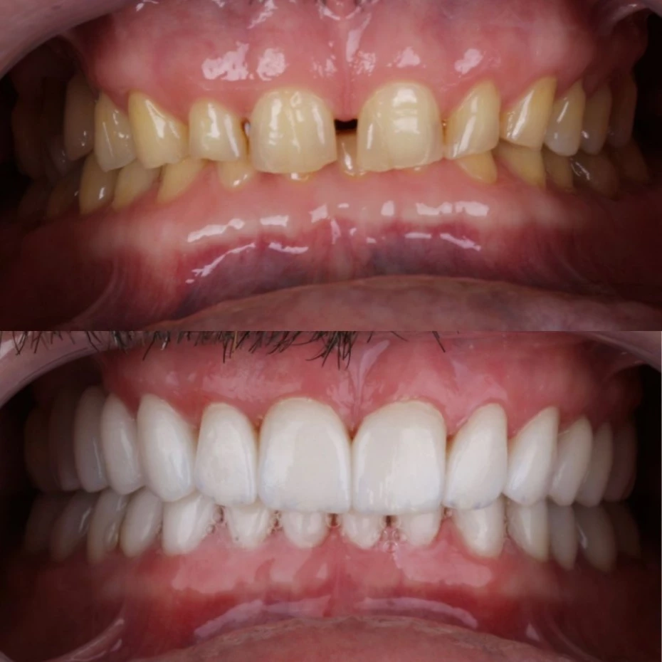 Foto 13:  — Natalia Zuin - Odontologia Integrativa